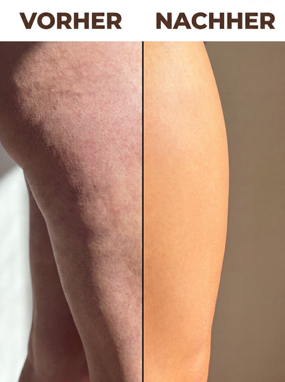 EVORA Cellulite Creme